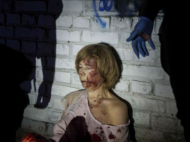 An injured woman sits near her house, which was damaged by a Russian airstrike, in a residential neighbourhood in Kyiv, Ukraine, on Thursday, April 24, 2025. (AP Photo/Evgeniy Maloletka)