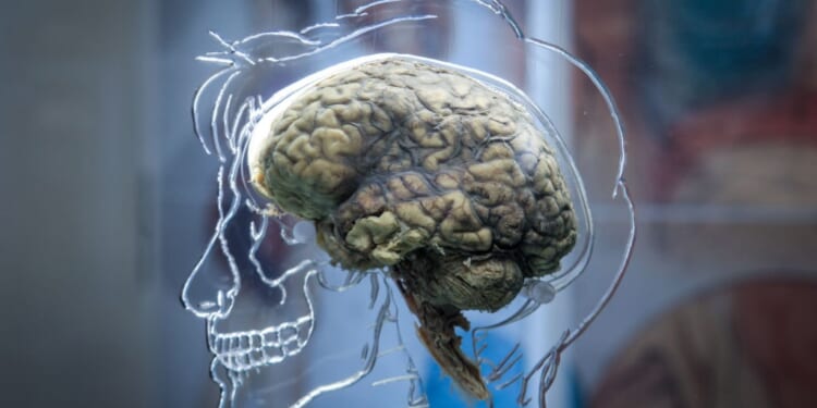 High on Health: Ages of the Brain