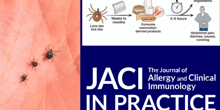 Pilot father is first documented death from meat allergy ‘caused by tick bite’ – One America News Network