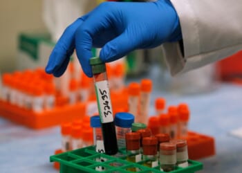 Should You Take a Blood Test to Detect Cancer?