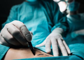 A close-up of a plastic surgeon marking the human skin for surgery.
