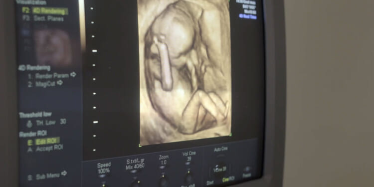 How the Abortion Pill Is Changing the Post-Roe Fight