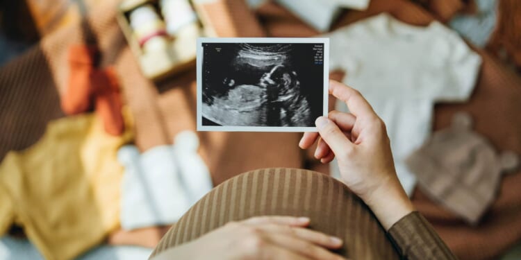 How to Conceive of Conception