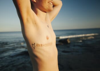 Plastic surgeons ditch gender ideology